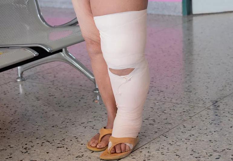 Frequently Asked Questions Regarding Wearing Compression Bandages -  Lymphedema Therapy Specialists