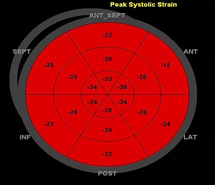 Systolic strain bull’s eye profile 