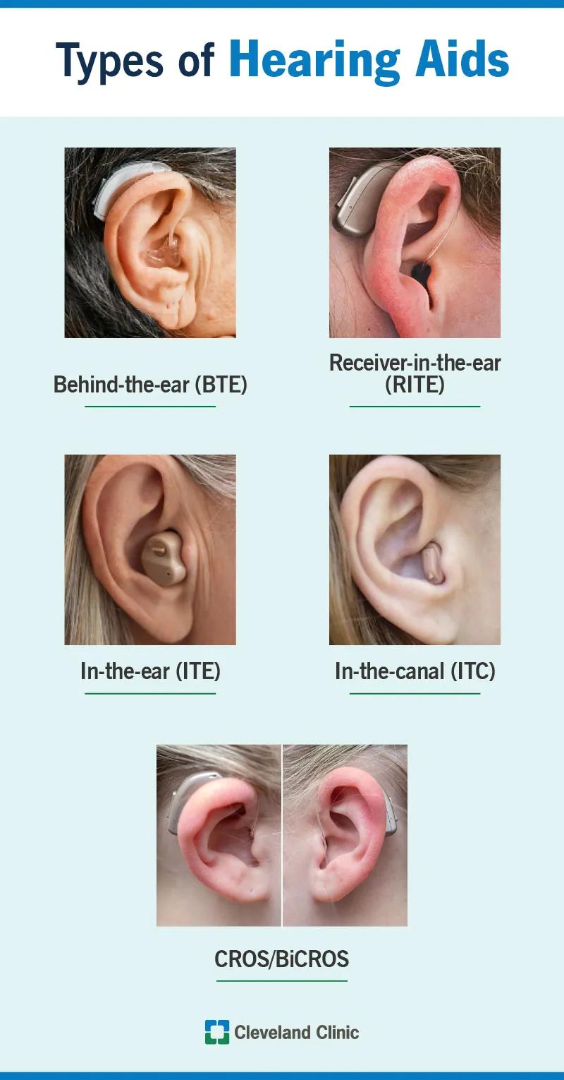 Types of hearing aids, including behind the ear, receiver in the ear in ear, in canal, CROS/BiCROS