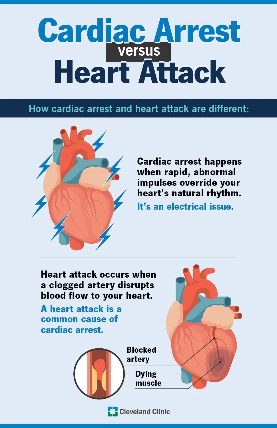 An illustrated infographic listing the differences between cardiac arrest and a heart attack
