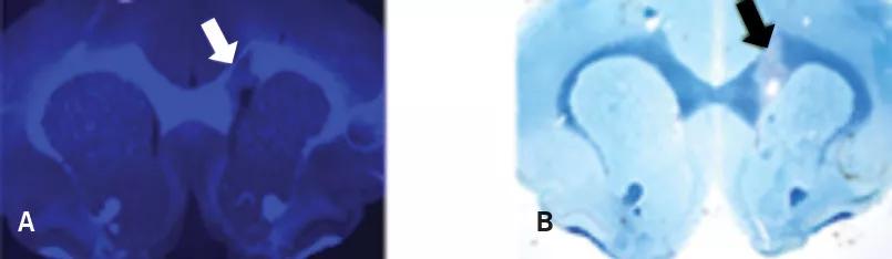 Myelivid stains normal myelin and sensitively detects myelin lesions