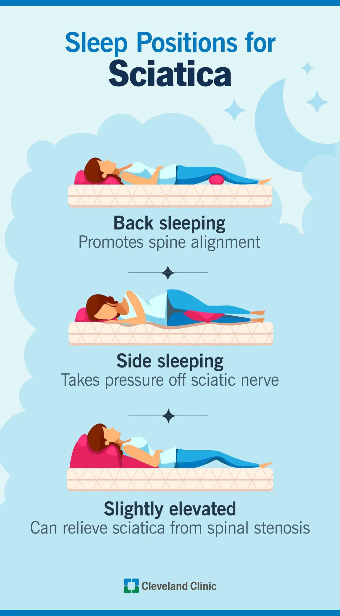 Best positions for sciatica