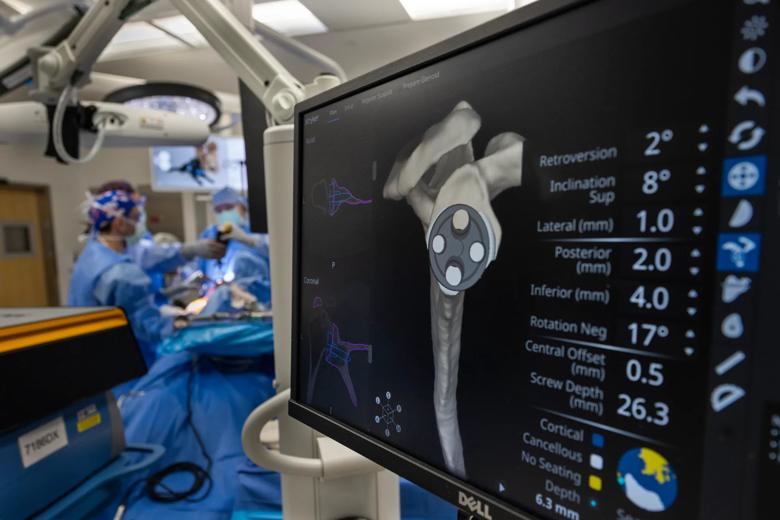 Computer screen showing planning for a robot-assisted surgery