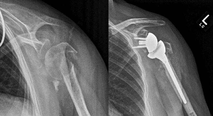 X-rays