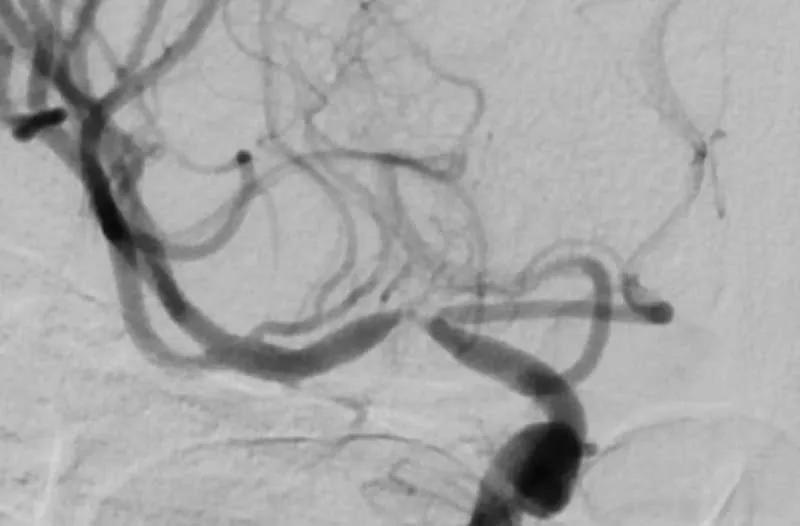 scan of blood vessels