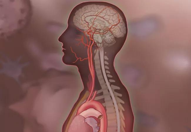 Autoimmunity and Postural Orthostatic Tachycardia Syndrome: Implications in  Diagnosis and Management