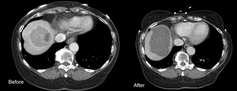 Abdomen x-ray