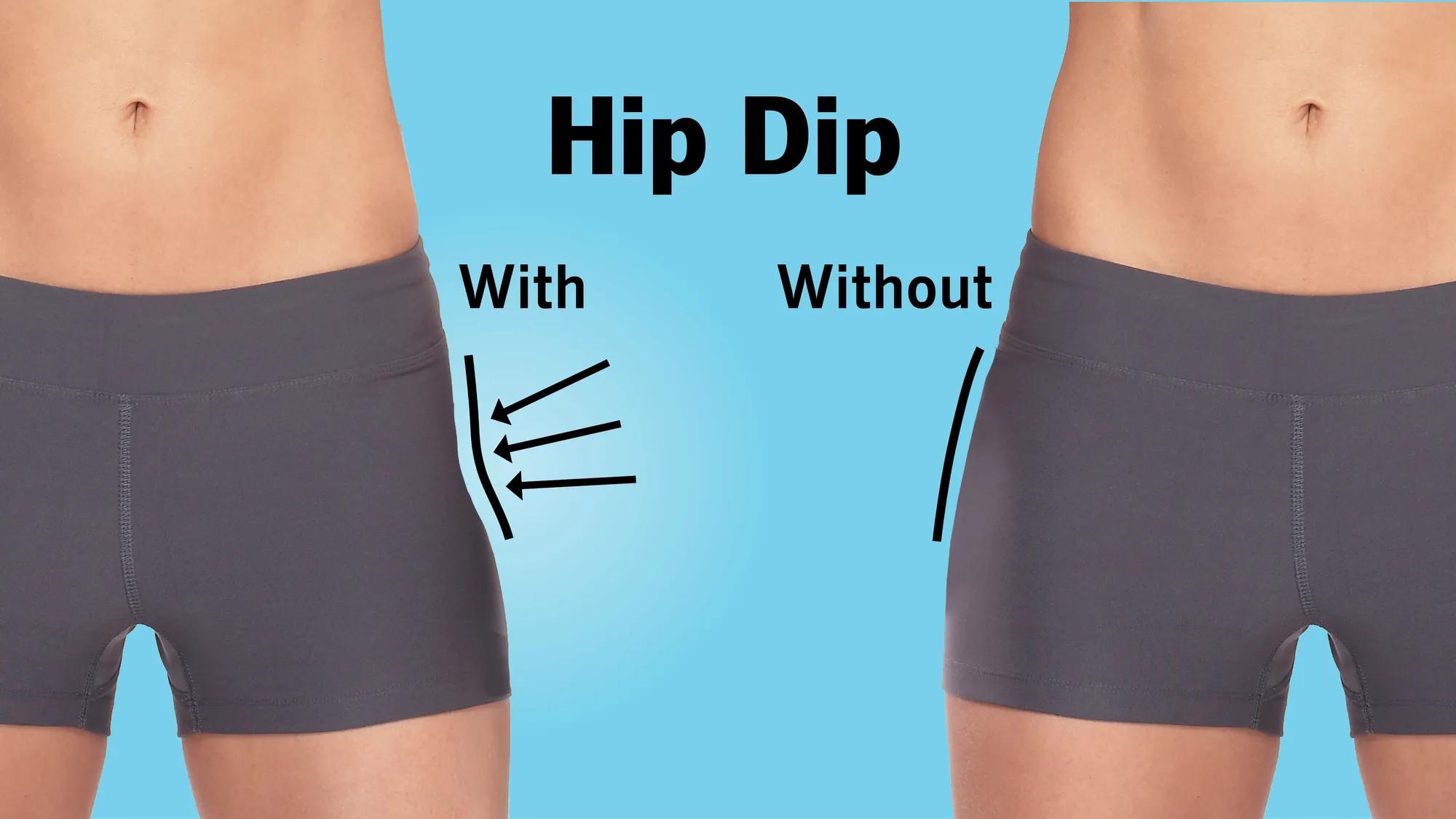 skinny tiny bent over tight Hip Dips: What They Are and Can You Get Rid of Them