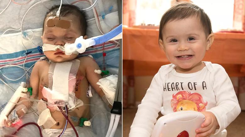 Jeremiah had open-heart surgery at Cleveland Clinic Children’s to repair a hole in the lower chambers of his heart.