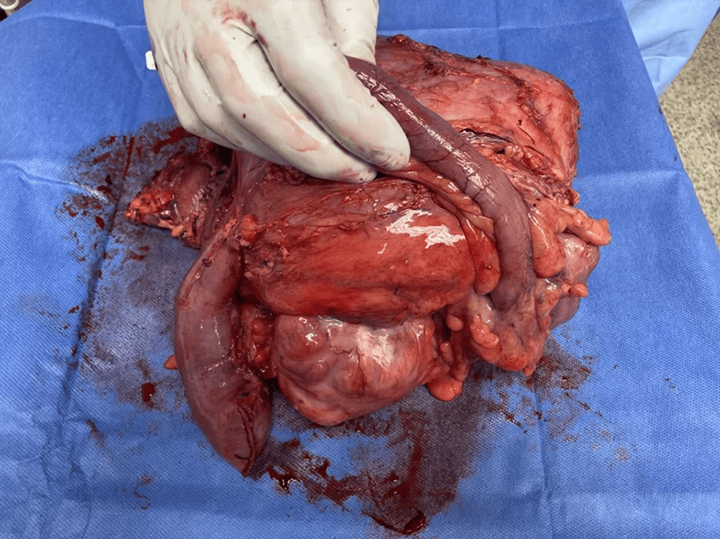 Surgery