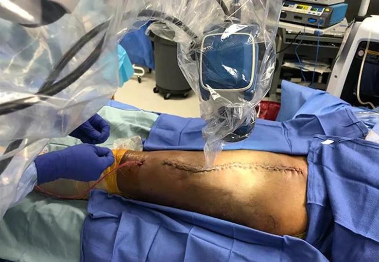 Leg of patient in surgery with large incision