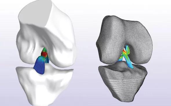 Figure 1. Joint anatomy and tissue mechanical properties can be represented in a computational model where simulations under various loading conditions can predict knee movements and deformations and stresses within tissues. When developed appropriately and evaluated adequately, such models can be reused for scientific conduct, training, design of engineering interventions and assessment of surgical procedures— and eventually for patient-specific diagnosis and treatment. Open Knee(s) provides an open, collaborative platform grounded in the scientific and translational capacity of musculoskeletal joint modeling and engages engineers, physicians and the user community to tackle the daunting development and evaluation process.