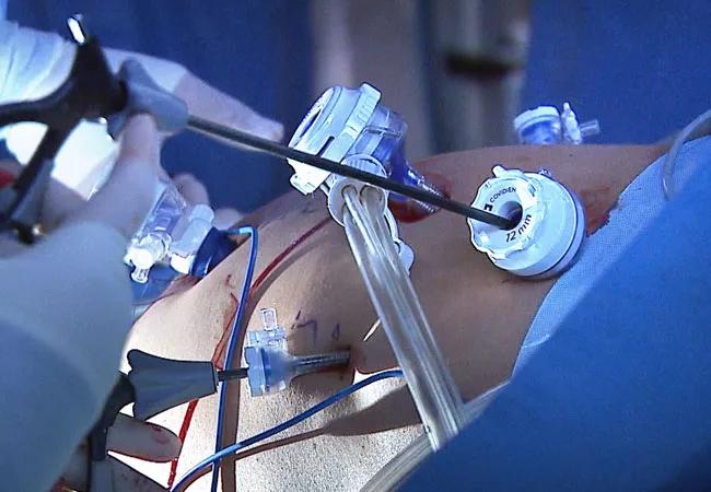 First Purely Laparoscopic Living Donor Hepatectomy for Liver