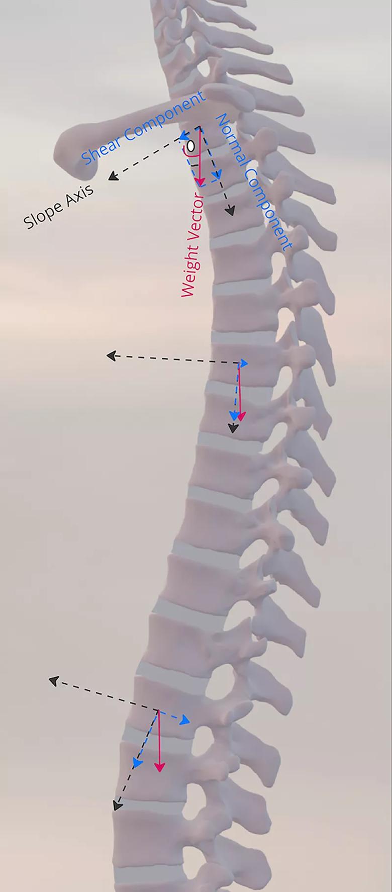 anatomic spine with local coordinate system