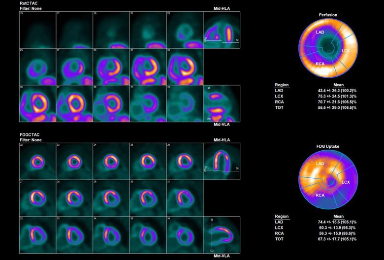 series of cardiac PET scans