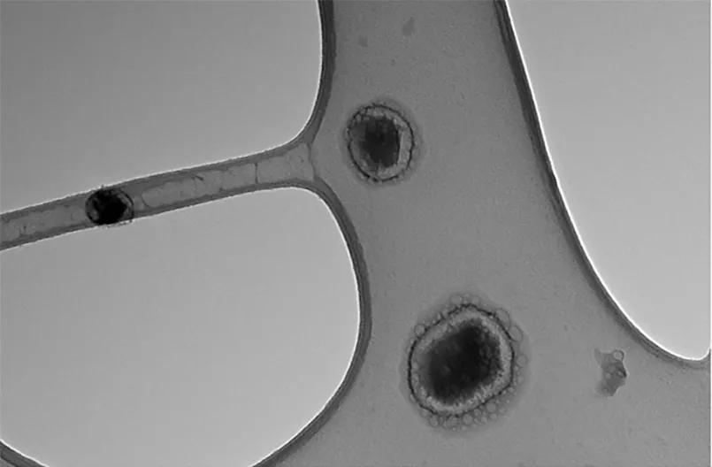 Exosomes viewed through a transmission electron microscope