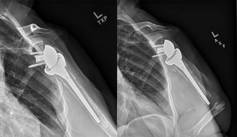 X-rays