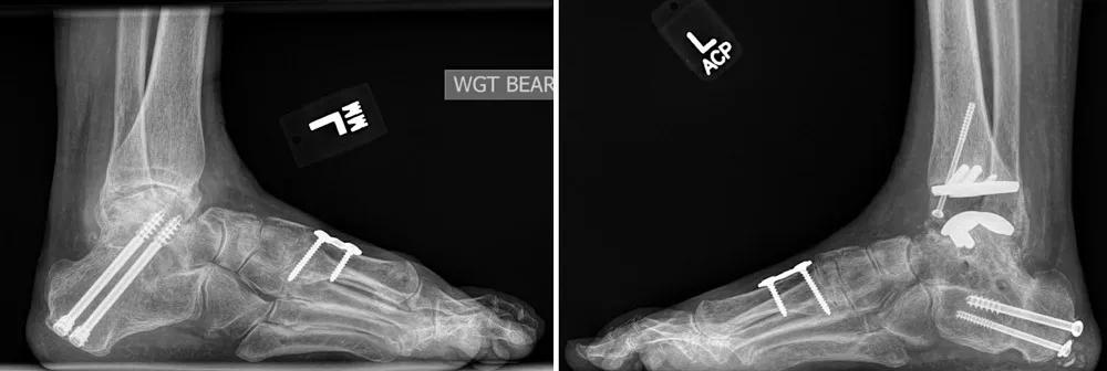 X-ray scans of the foot and ankle.