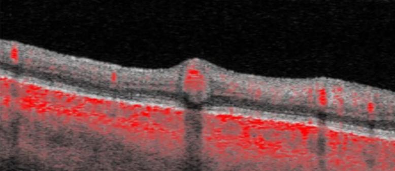 Layers of the retina highlighted in red