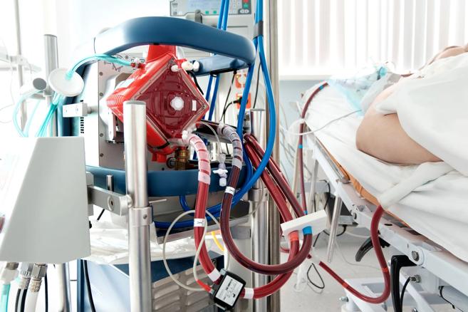 ECMO machine hooked up to a hospital patient