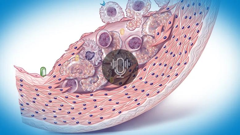 illustration of macrophages interacting with blood vessel wall, with podcast icon overlay