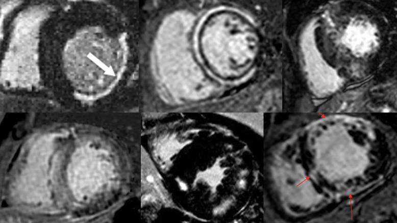 six panels of black-and-white heart imaging studies grouped in a rectangle