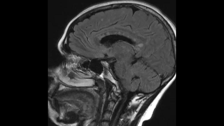 MRI scan of the side of a human head