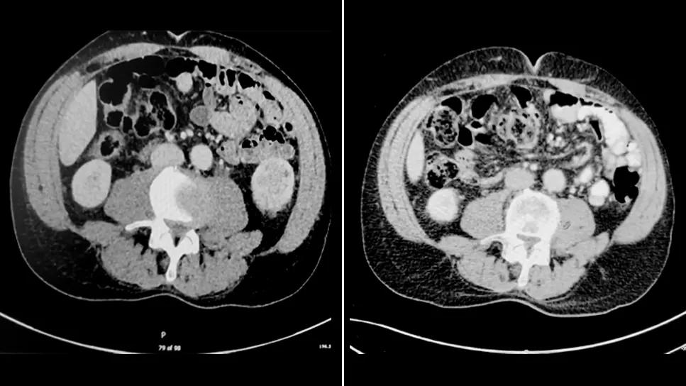 Before and after scan