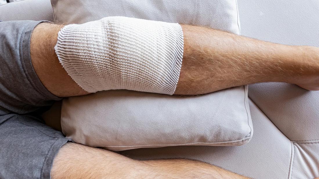 Person resting on couch with bandaged knee elevated on couch pillow