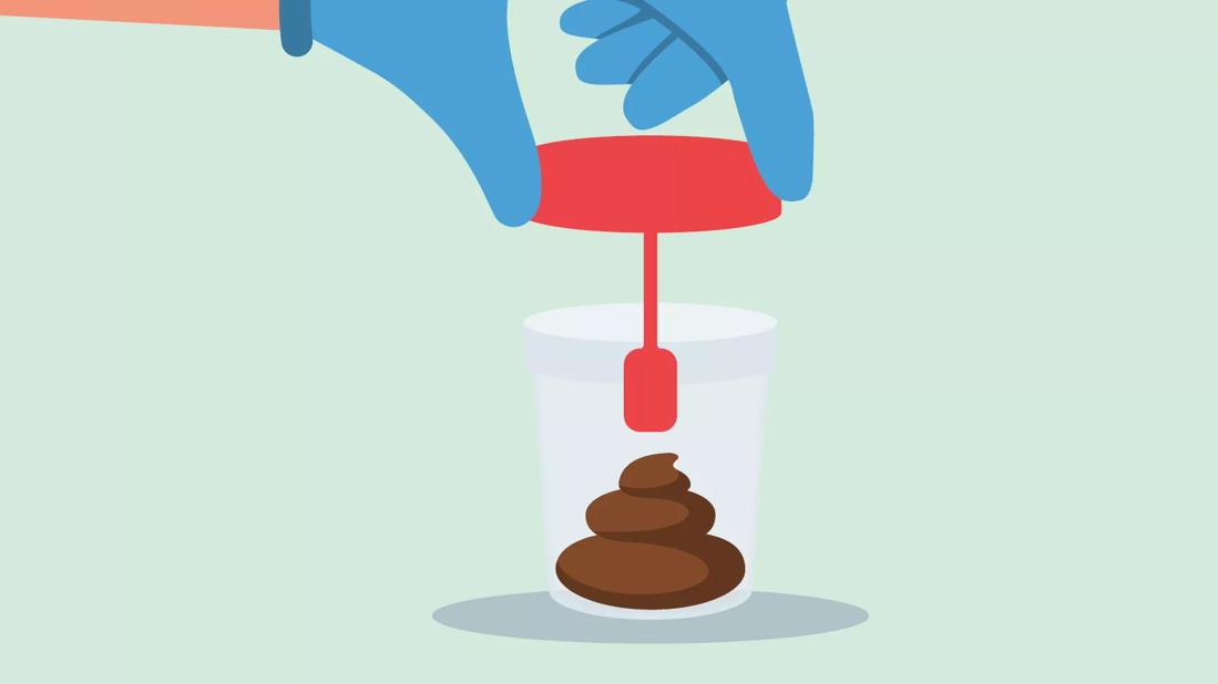 An illustration of a gloved hand putting a lid on a stool sample