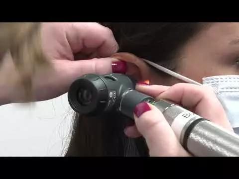 FDA approved over-the-counter hearing aids