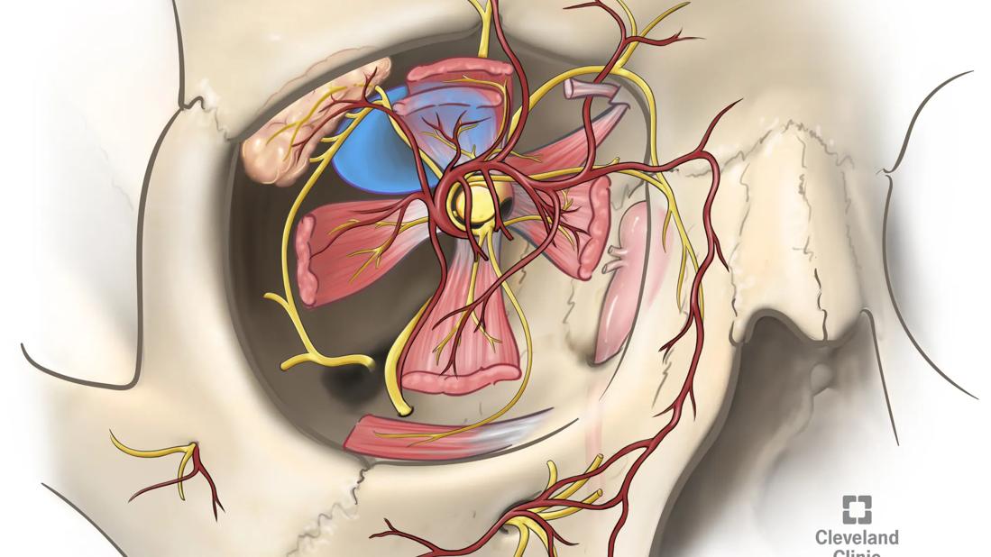 23-EYE-4079212-Orbital-tumor-CQD
