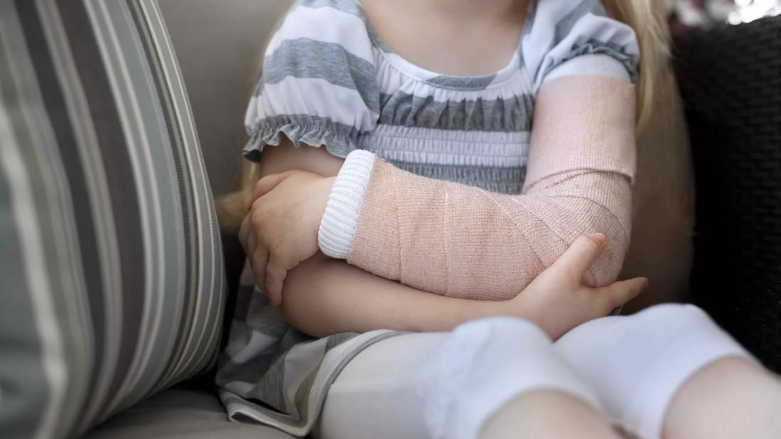 Child with broken arm