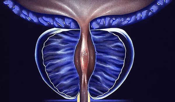 650&#215;450-Prostate