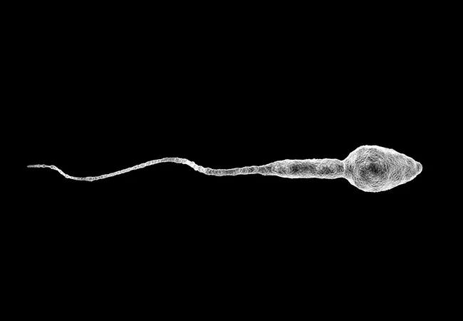 Sperm motility