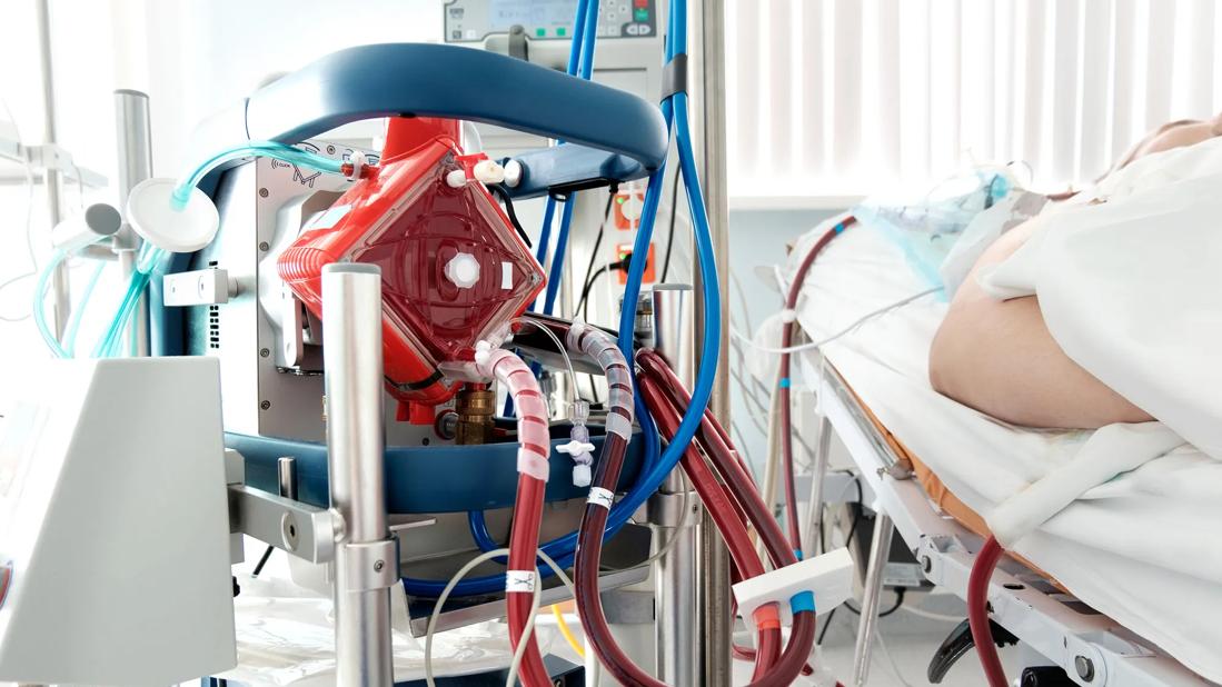 ECMO machine