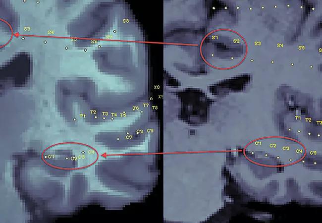 18-NEU-822-Information-Guided-Neuro-650&#215;450