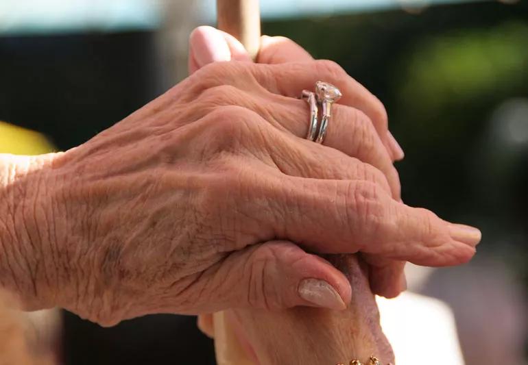 Elderly woman's arthritic hands