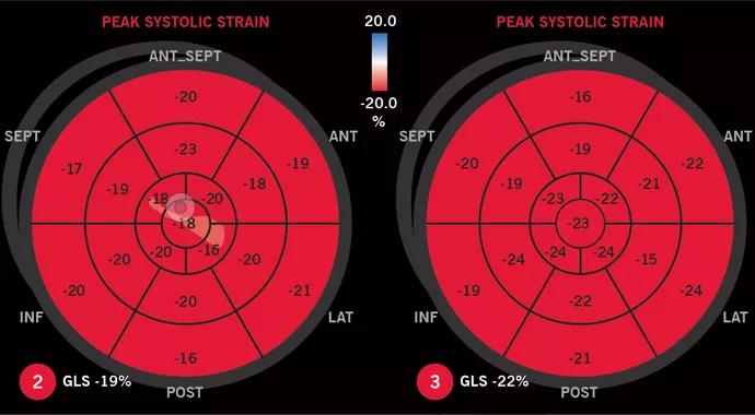 Strain-Ecco-690