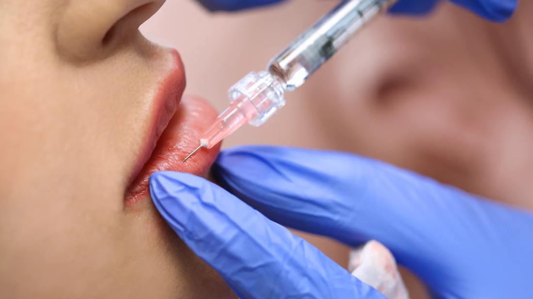 Needle being injected into lips by gloved hands