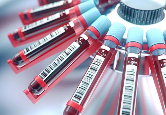 Lab equipment centrifuging blood. Concept image of a blood test.3d rendering.