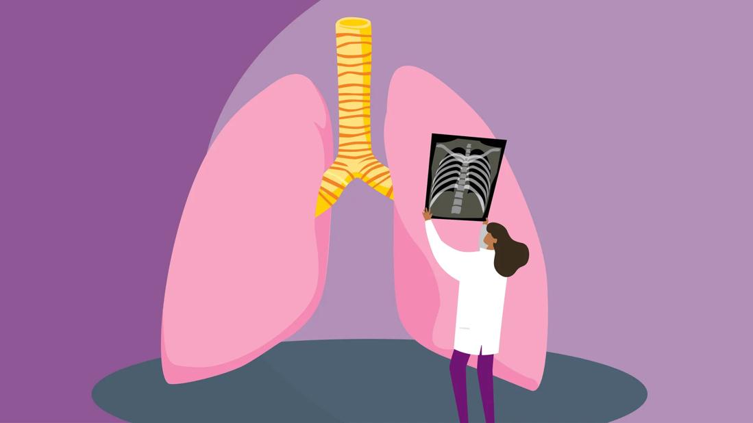 bronchitis or pneumonia