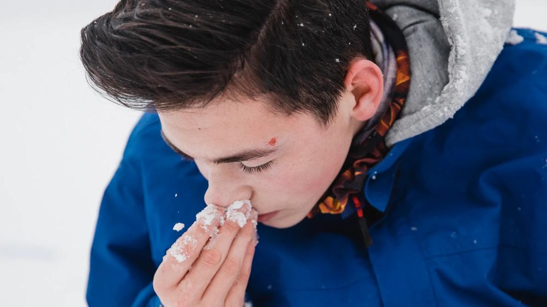 boy with nosebleed in winter