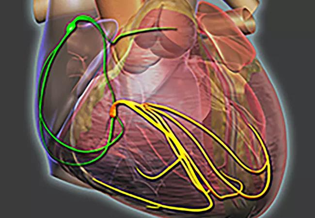 20-HVI-1979914_heart-conduction_650x450