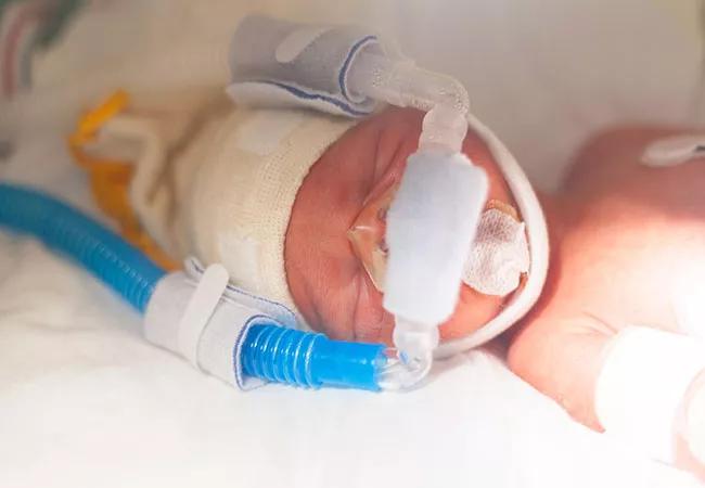 650&#215;450-Nasal-Injuries-NICU-babies