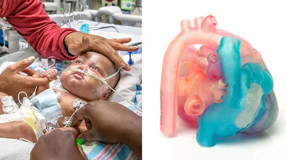 健康・医学 Surgery for congenital heart defects Surgery for Congenital Heart Defects, 3rd Edition | Wiley