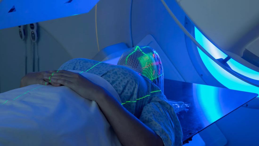 Woman Receiving Radiation Therapy Treatments for Head &amp; NeckCancer