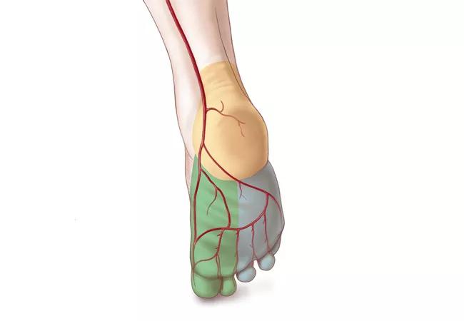 Critical Limb Ischemia