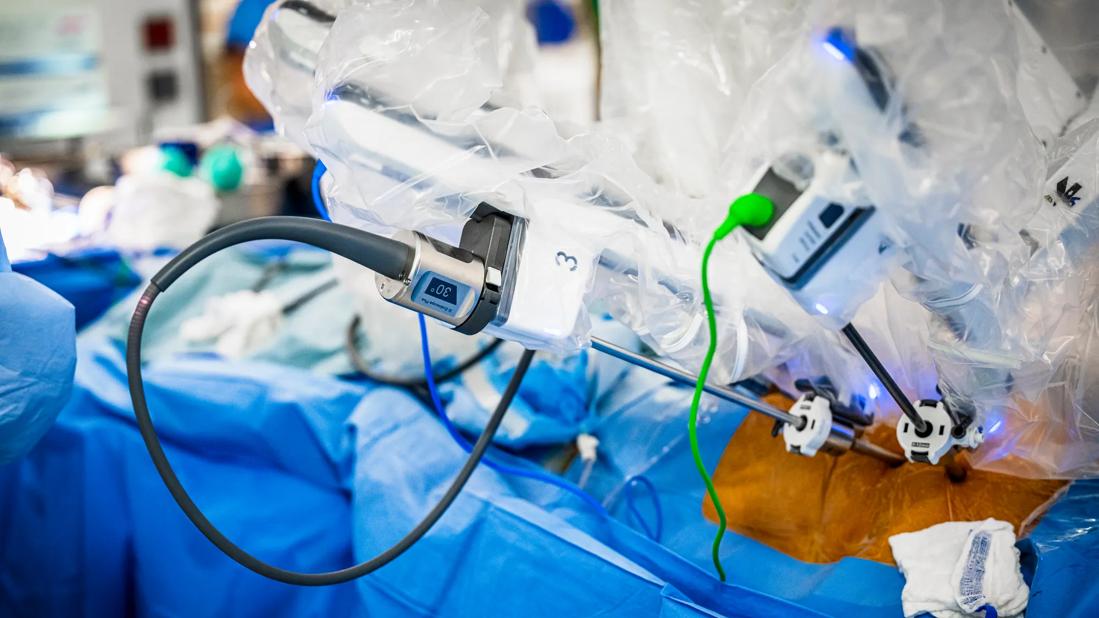 robotic arm ports in a cardiac surgery operation