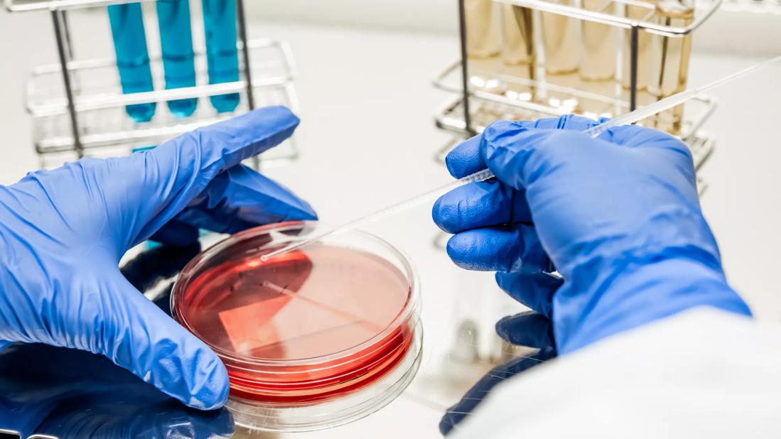 Researcher working with petri dish